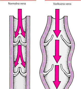 Venax